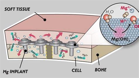  Xenograftmaterial: Förstärkning av Implantat och Benreparationer i Framtiden?